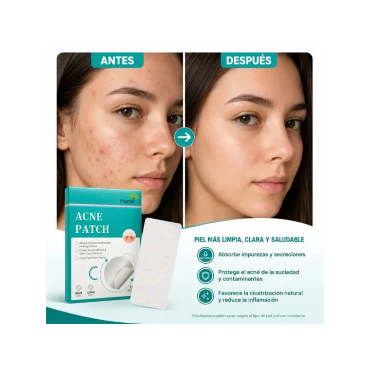 Parches  De Acné 72 Pcs
